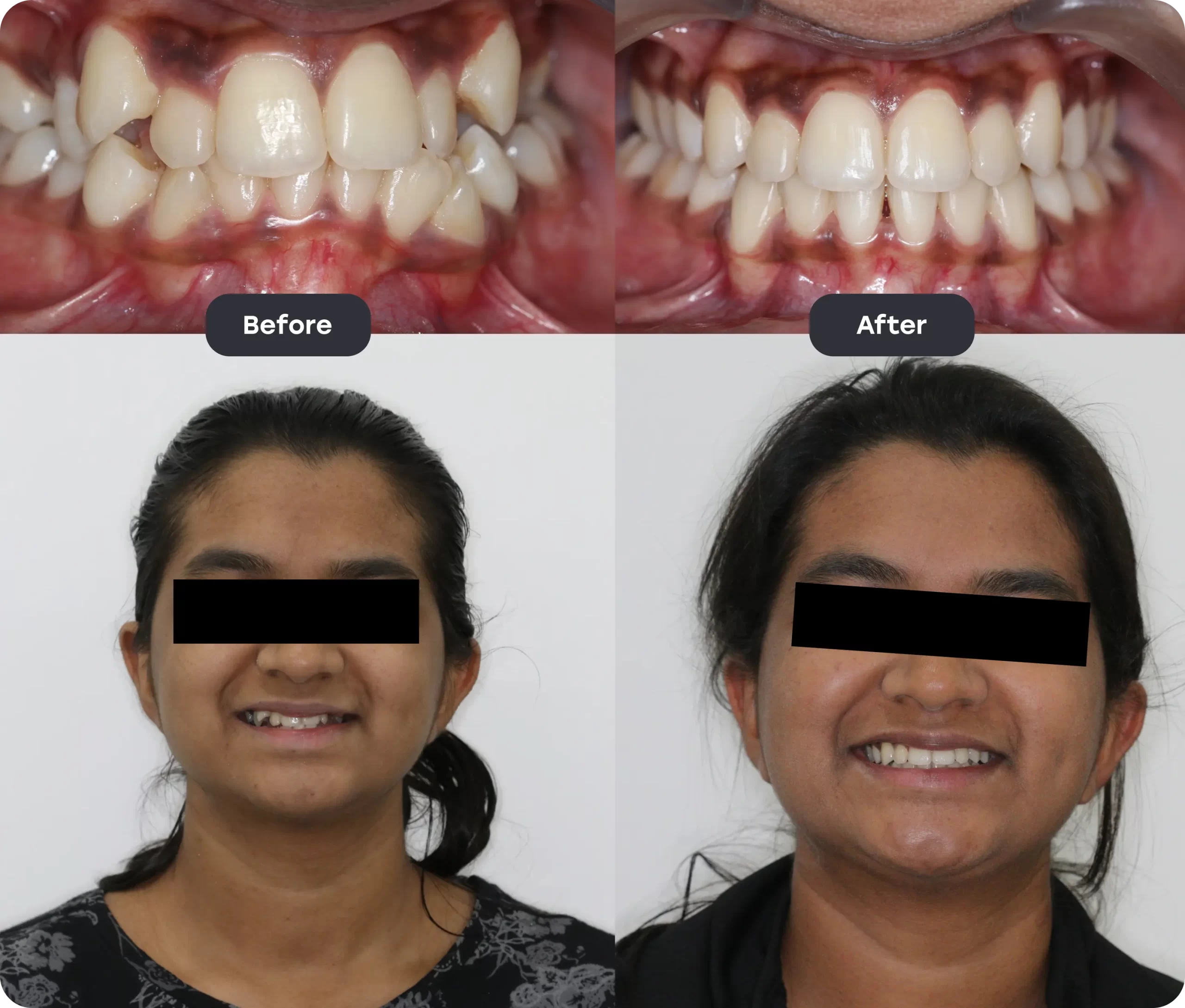 Before and After