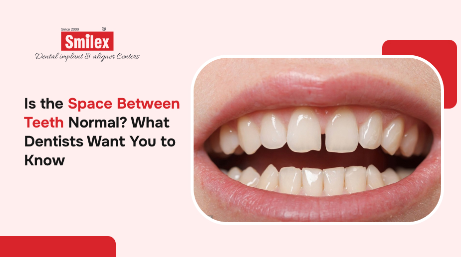 Is the Space Between Teeth Normal? What Dentists Want You to Know