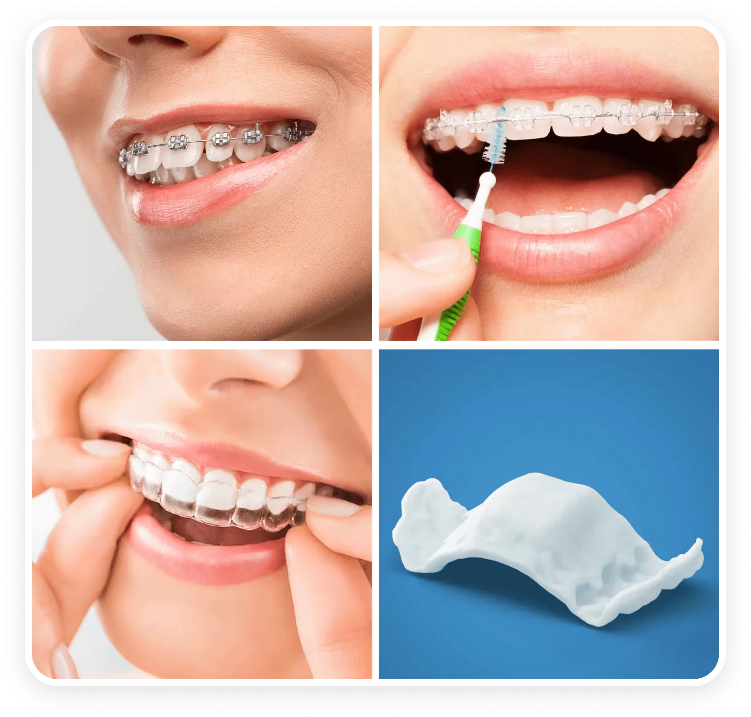 Orthodontic Treatment