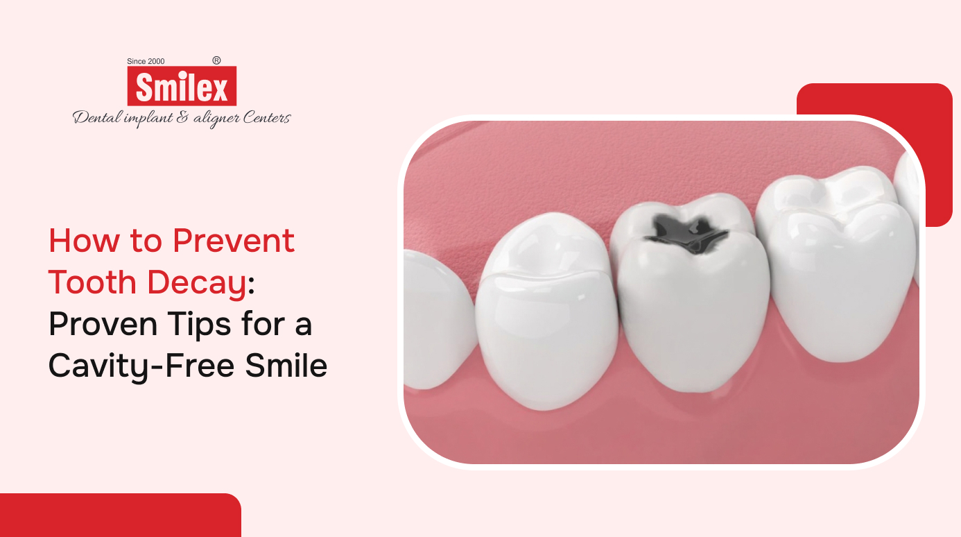 How to Prevent Tooth Decay: Proven Tips for a Cavity-Free Smile